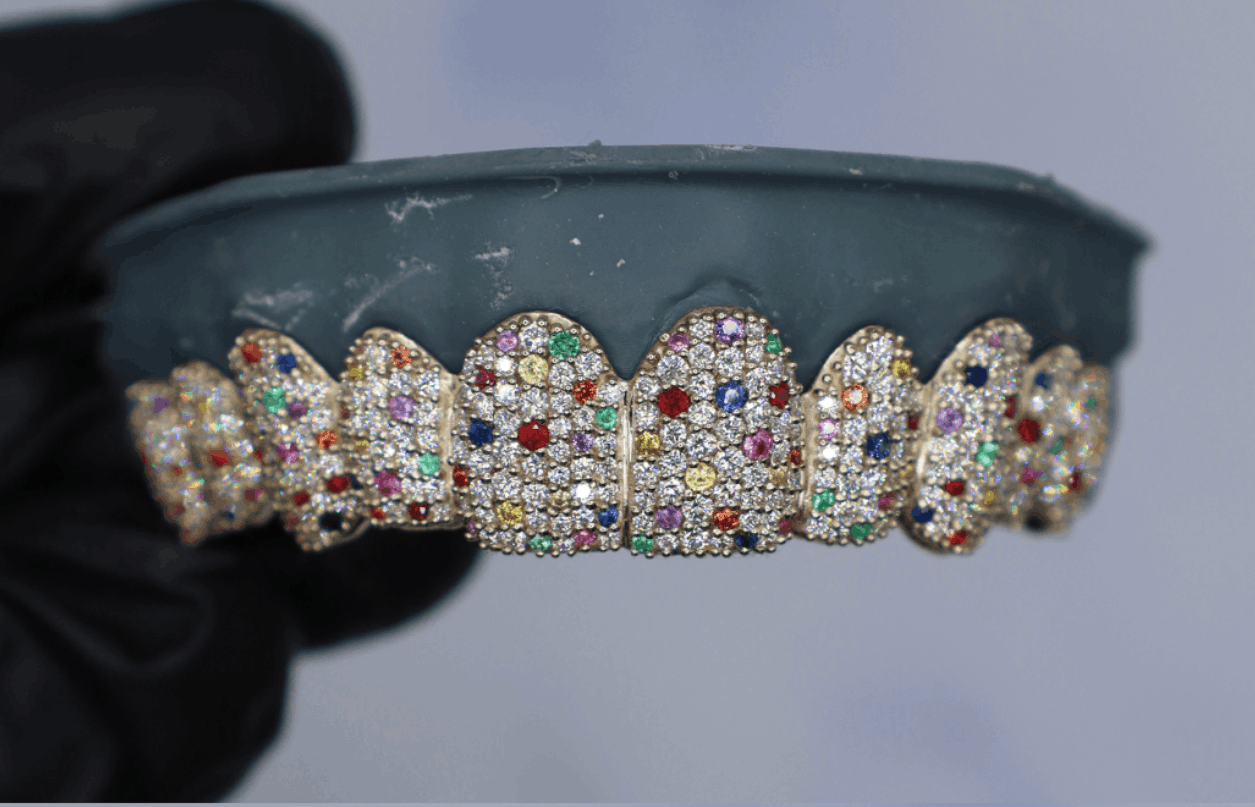 customized dental grillz in Auburn Hills MI from Pristine Dental Care